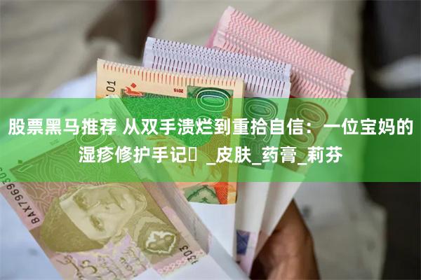 股票黑马推荐 从双手溃烂到重拾自信：一位宝妈的湿疹修护手记​_皮肤_药膏_莉芬